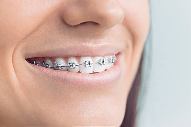 Best Traditional Braces  in Midfield, AL